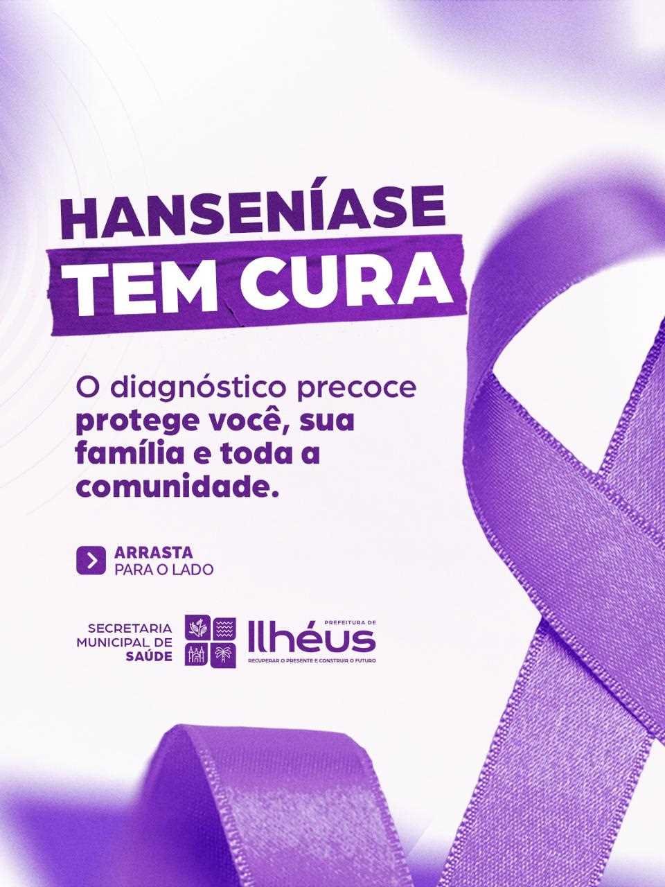 Janeiro Roxo: Ilhéus intensifica ações de combate à hanseníase e enfrentamento ao preconceito.